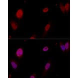 Immunofluorescence - Anti-PTBP1 Antibody (A13686) - Antibodies.com