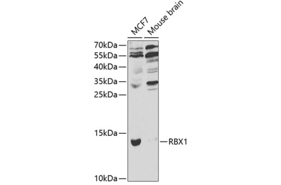 Western Blot - Anti-RBX1 Antibody (A13687) - Antibodies.com