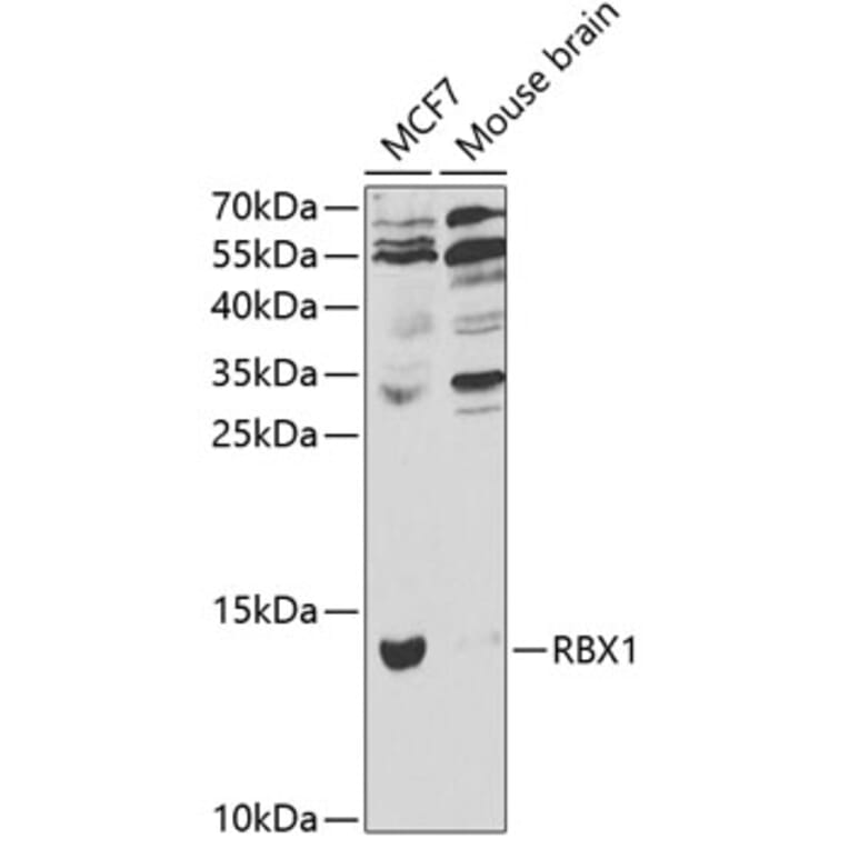 Western Blot - Anti-RBX1 Antibody (A13687) - Antibodies.com