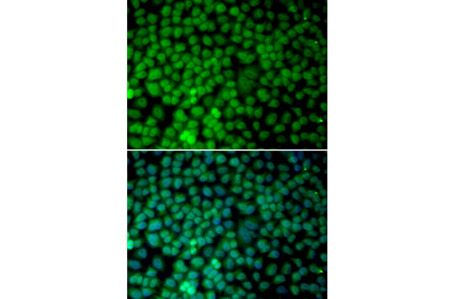 Immunofluorescence - Anti-RBX1 Antibody (A13687) - Antibodies.com