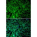 Immunofluorescence - Anti-RBX1 Antibody (A13687) - Antibodies.com