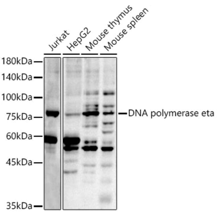 Western Blot - Anti-DNA polymerase eta Antibody (A13688) - Antibodies.com