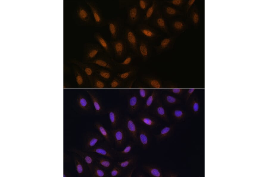 Immunofluorescence - Anti-DNA polymerase eta Antibody (A13688) - Antibodies.com