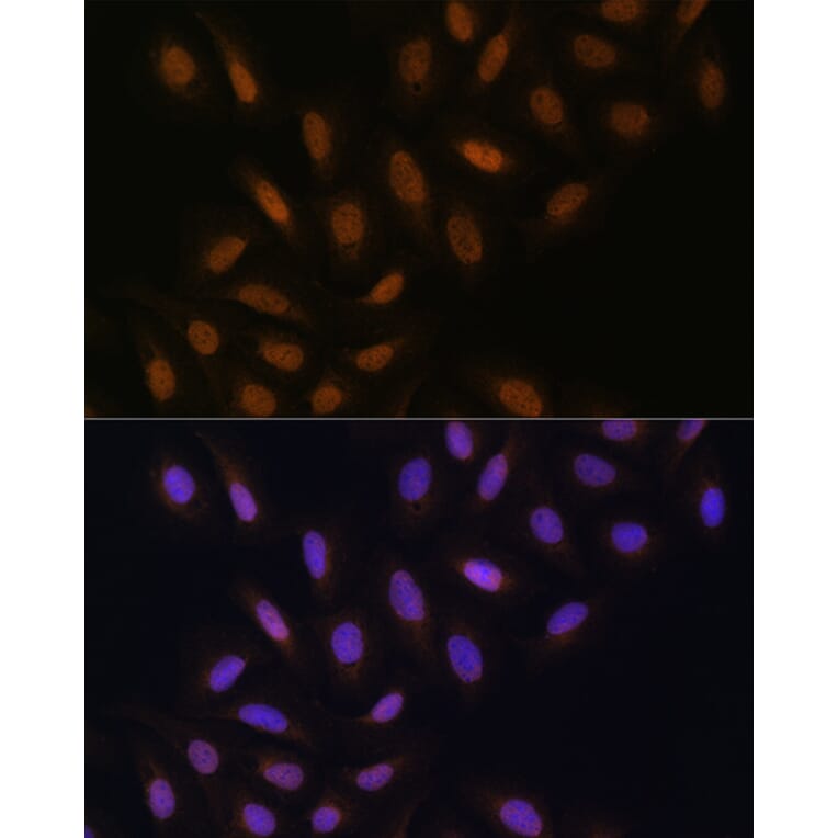 Immunofluorescence - Anti-DNA polymerase eta Antibody (A13688) - Antibodies.com