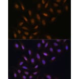 Immunofluorescence - Anti-DNA polymerase eta Antibody (A13688) - Antibodies.com