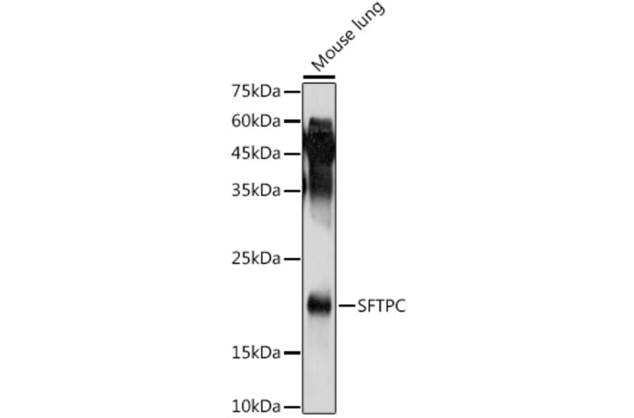 Western Blot - Anti-Prosurfactant Protein C Antibody (A13690) - Antibodies.com