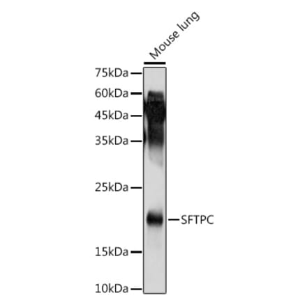 Western Blot - Anti-Prosurfactant Protein C Antibody (A13690) - Antibodies.com