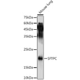 Western Blot - Anti-Prosurfactant Protein C Antibody (A13690) - Antibodies.com