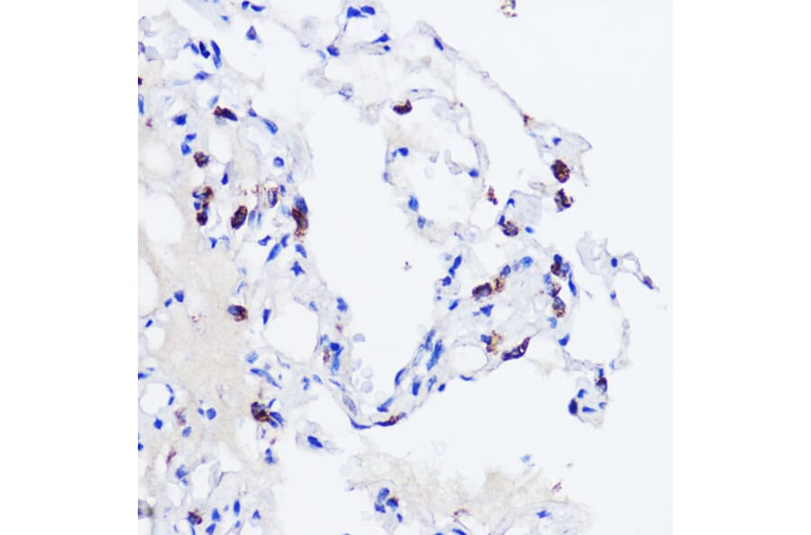 Immunohistochemistry - Anti-Prosurfactant Protein C Antibody (A13690) - Antibodies.com