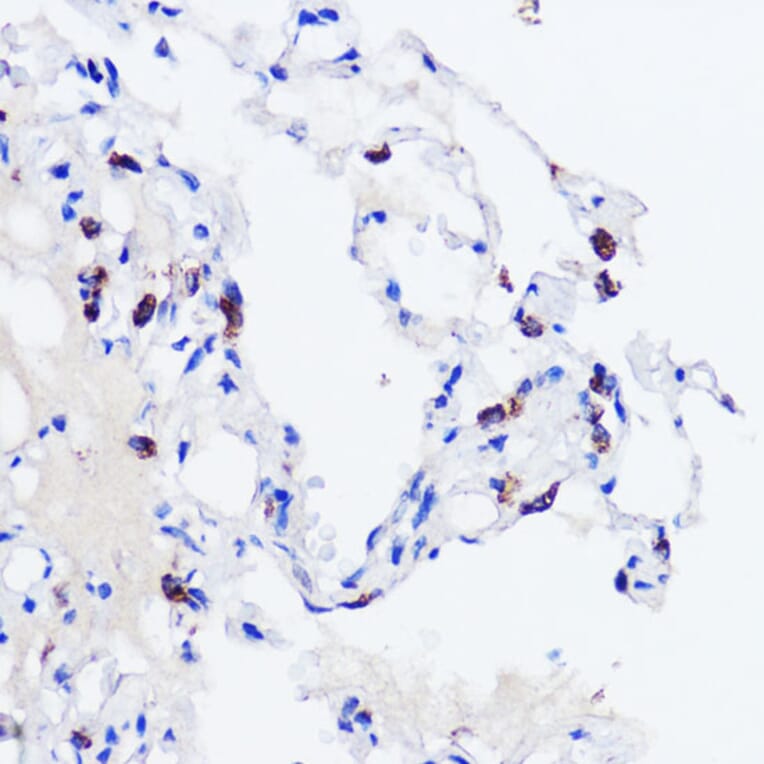 Immunohistochemistry - Anti-Prosurfactant Protein C Antibody (A13690) - Antibodies.com
