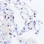 Immunohistochemistry - Anti-Prosurfactant Protein C Antibody (A13690) - Antibodies.com