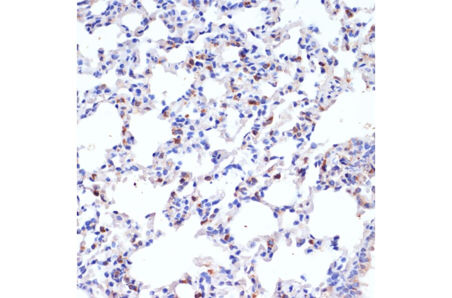Immunohistochemistry - Anti-Prosurfactant Protein C Antibody (A13690) - Antibodies.com