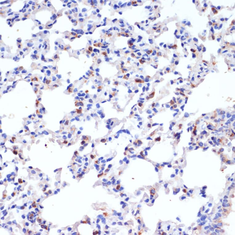 Immunohistochemistry - Anti-Prosurfactant Protein C Antibody (A13690) - Antibodies.com