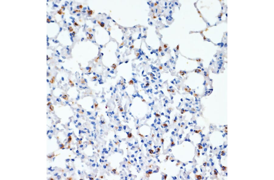 Immunohistochemistry - Anti-Prosurfactant Protein C Antibody (A13690) - Antibodies.com