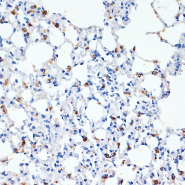 Immunohistochemistry - Anti-Prosurfactant Protein C Antibody (A13690) - Antibodies.com