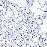 Immunohistochemistry - Anti-Prosurfactant Protein C Antibody (A13690) - Antibodies.com