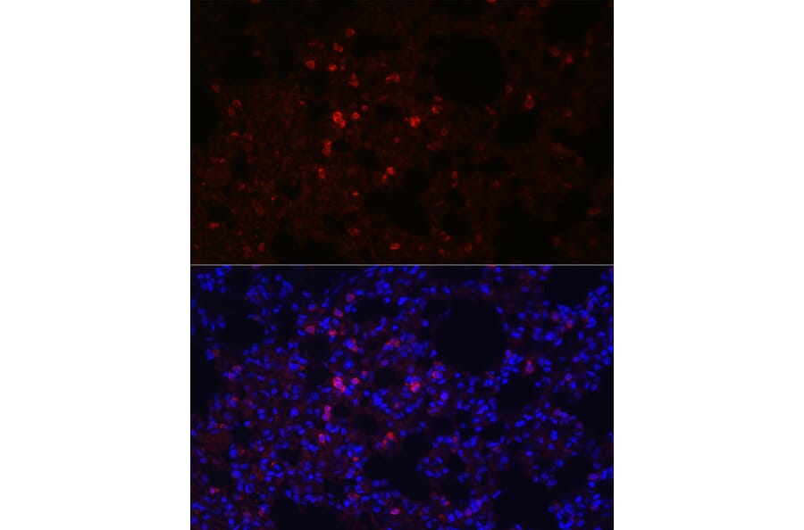 Immunofluorescence - Anti-Prosurfactant Protein C Antibody (A13690) - Antibodies.com