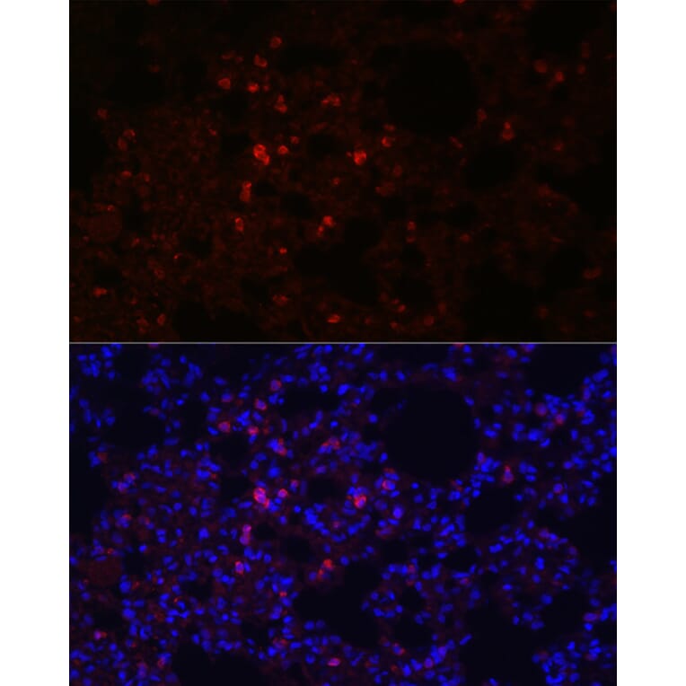 Immunofluorescence - Anti-Prosurfactant Protein C Antibody (A13690) - Antibodies.com