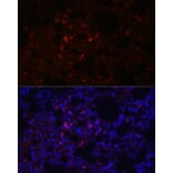 Immunofluorescence - Anti-Prosurfactant Protein C Antibody (A13690) - Antibodies.com