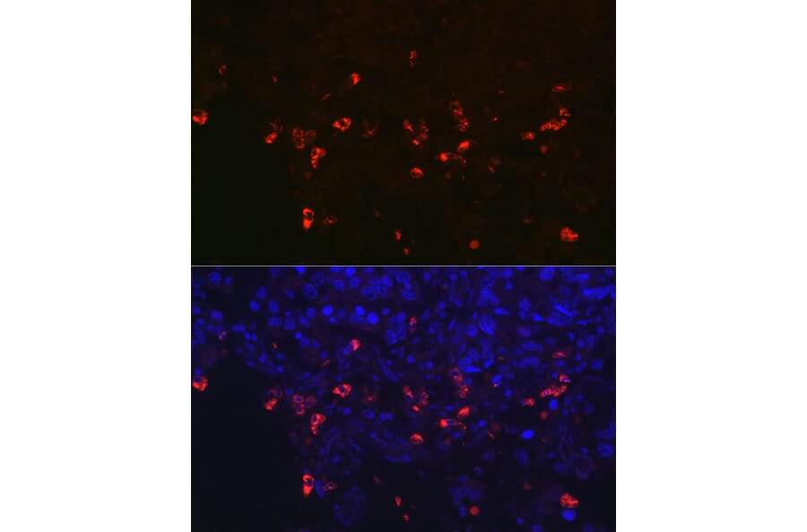Immunofluorescence - Anti-Prosurfactant Protein C Antibody (A13690) - Antibodies.com