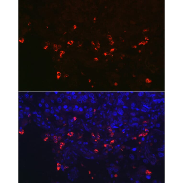 Immunofluorescence - Anti-Prosurfactant Protein C Antibody (A13690) - Antibodies.com