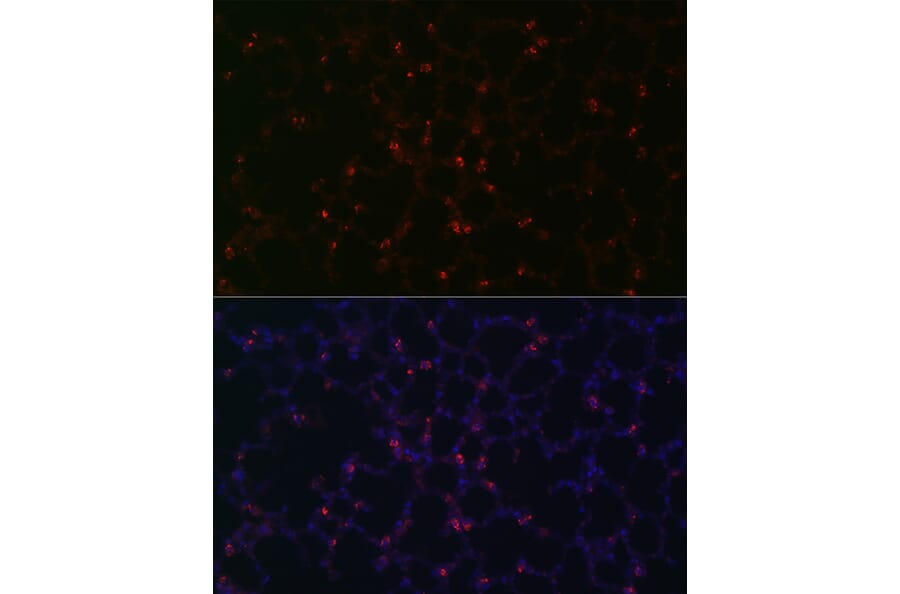 Immunofluorescence - Anti-Prosurfactant Protein C Antibody (A13690) - Antibodies.com