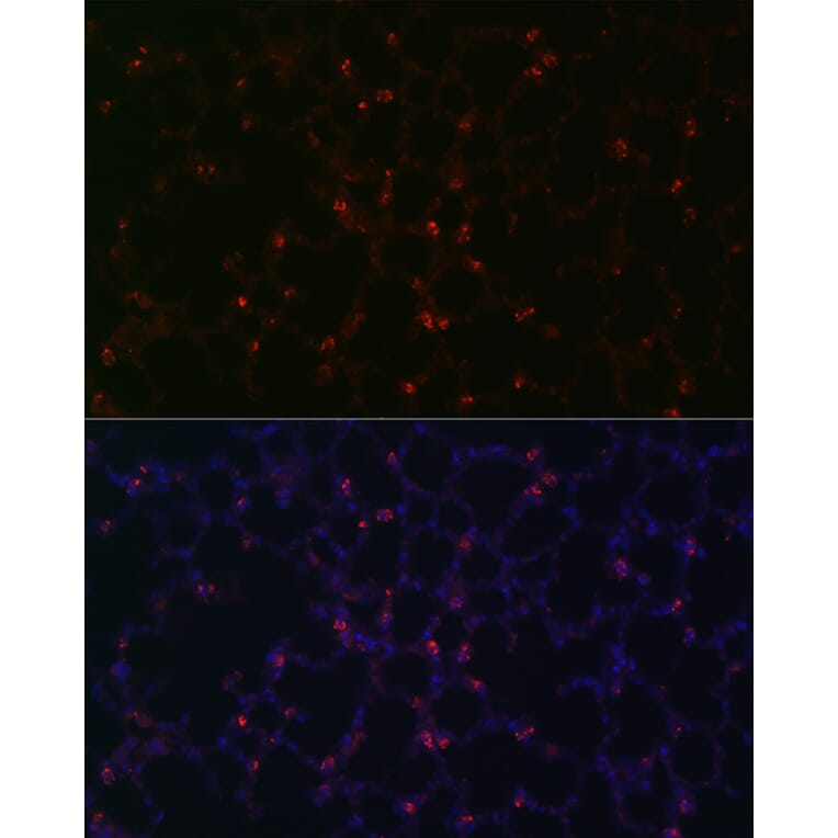 Immunofluorescence - Anti-Prosurfactant Protein C Antibody (A13690) - Antibodies.com