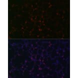 Immunofluorescence - Anti-Prosurfactant Protein C Antibody (A13690) - Antibodies.com