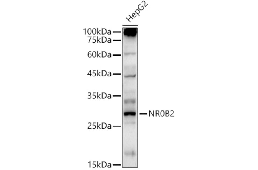 Western Blot - Anti-NR0B2 Antibody (A13691) - Antibodies.com