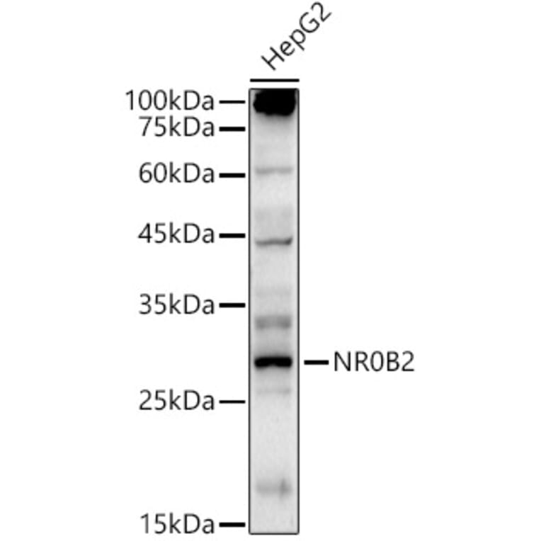 Western Blot - Anti-NR0B2 Antibody (A13691) - Antibodies.com