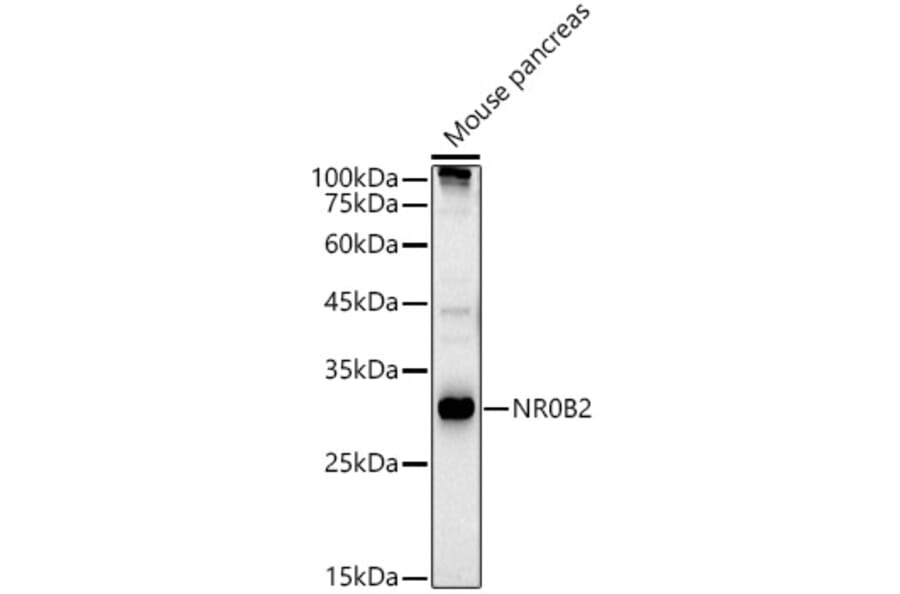 Western Blot - Anti-NR0B2 Antibody (A13691) - Antibodies.com