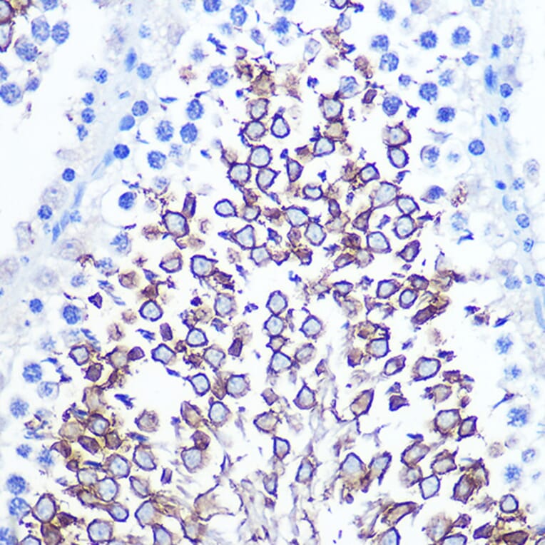 Immunohistochemistry - Anti-CD47 Antibody (A13692) - Antibodies.com