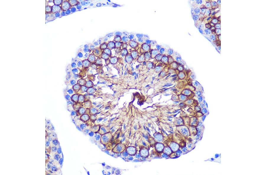 Immunohistochemistry - Anti-CD47 Antibody (A13692) - Antibodies.com