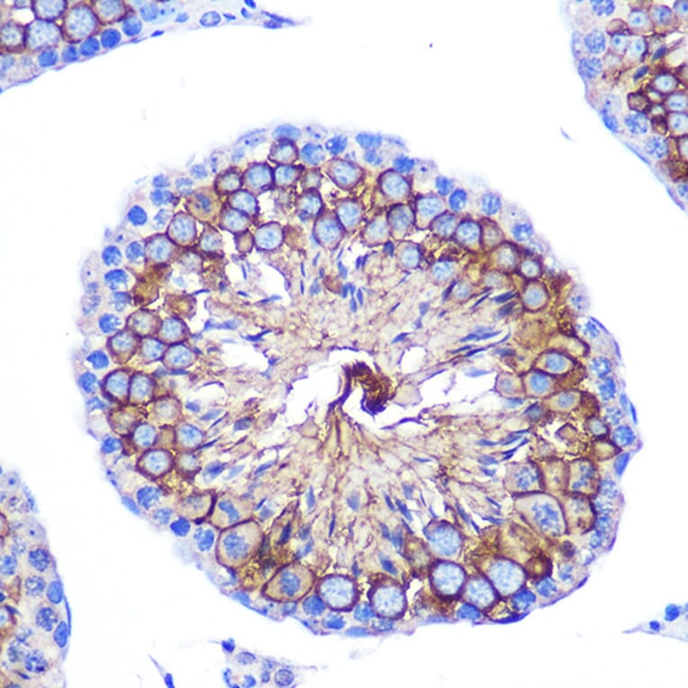 Immunohistochemistry - Anti-CD47 Antibody (A13692) - Antibodies.com