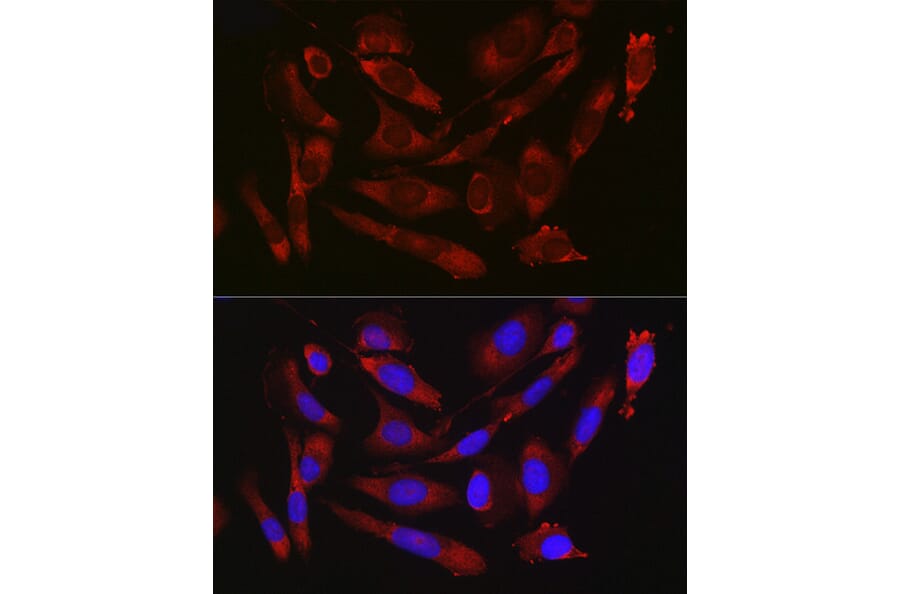 Immunofluorescence - Anti-CD47 Antibody (A13692) - Antibodies.com