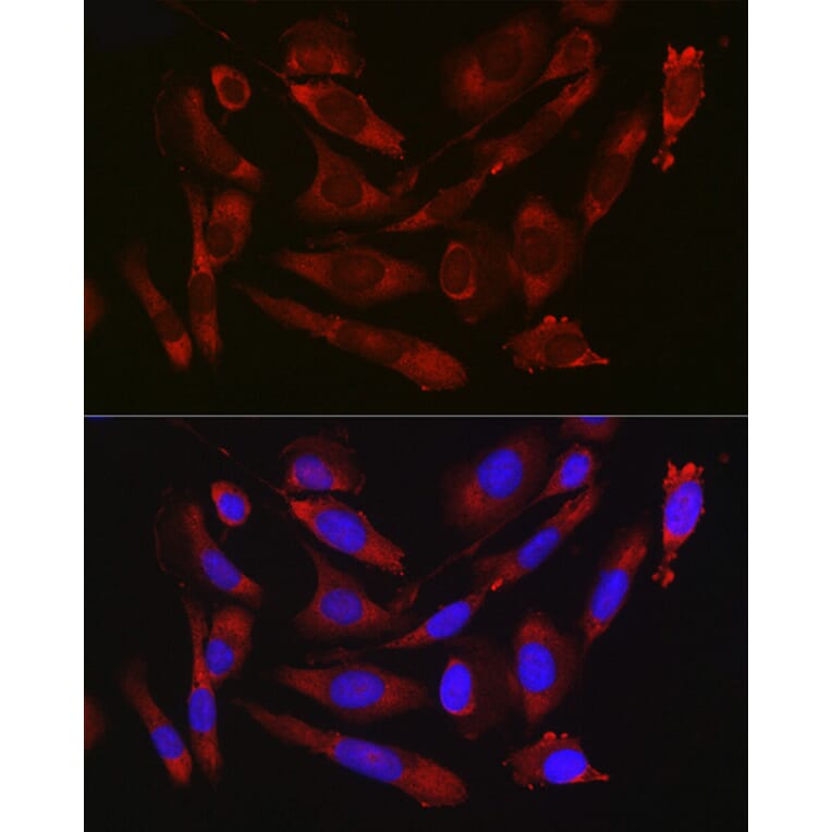 Immunofluorescence - Anti-CD47 Antibody (A13692) - Antibodies.com
