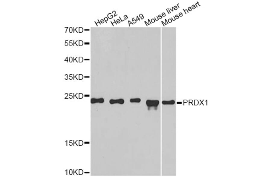Western Blot - Anti-PRDX1 Antibody (A1842) - Antibodies.com