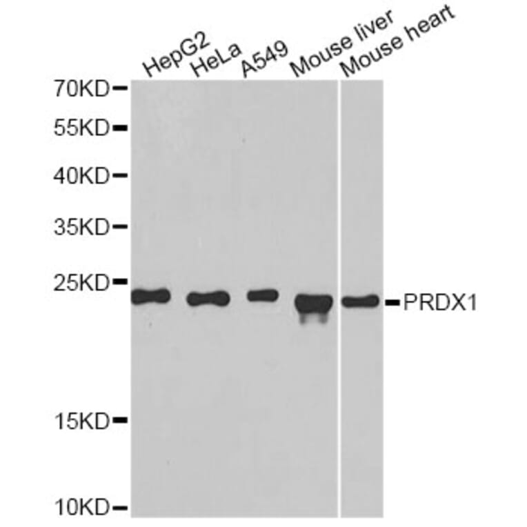 Western Blot - Anti-PRDX1 Antibody (A1842) - Antibodies.com