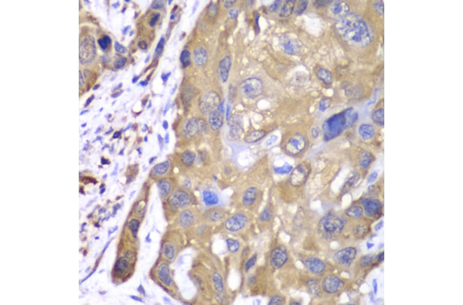 Immunohistochemistry - Anti-PRDX1 Antibody (A1842) - Antibodies.com