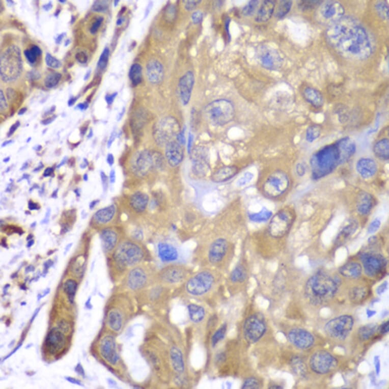 Immunohistochemistry - Anti-PRDX1 Antibody (A1842) - Antibodies.com