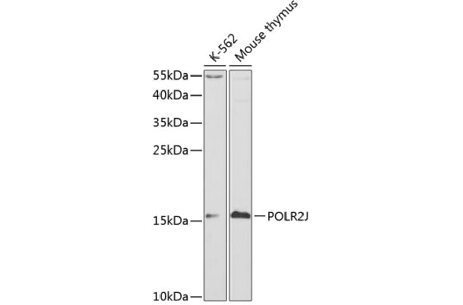 Western Blot - Anti-RNA polymeraseII RPB11 Antibody (A13695) - Antibodies.com