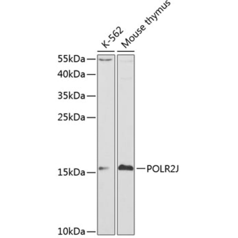 Western Blot - Anti-RNA polymeraseII RPB11 Antibody (A13695) - Antibodies.com