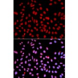 Immunofluorescence - Anti-RNA polymeraseII RPB11 Antibody (A13695) - Antibodies.com