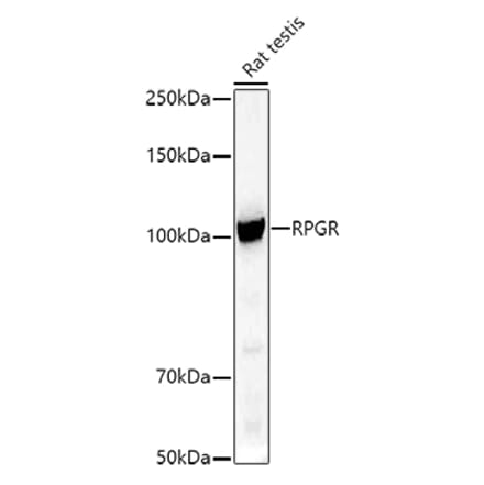 Western Blot - Anti-RPGR Antibody (A13696) - Antibodies.com