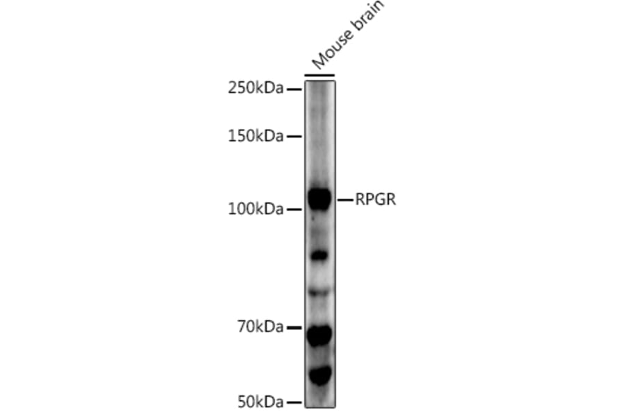 Western Blot - Anti-RPGR Antibody (A13696) - Antibodies.com