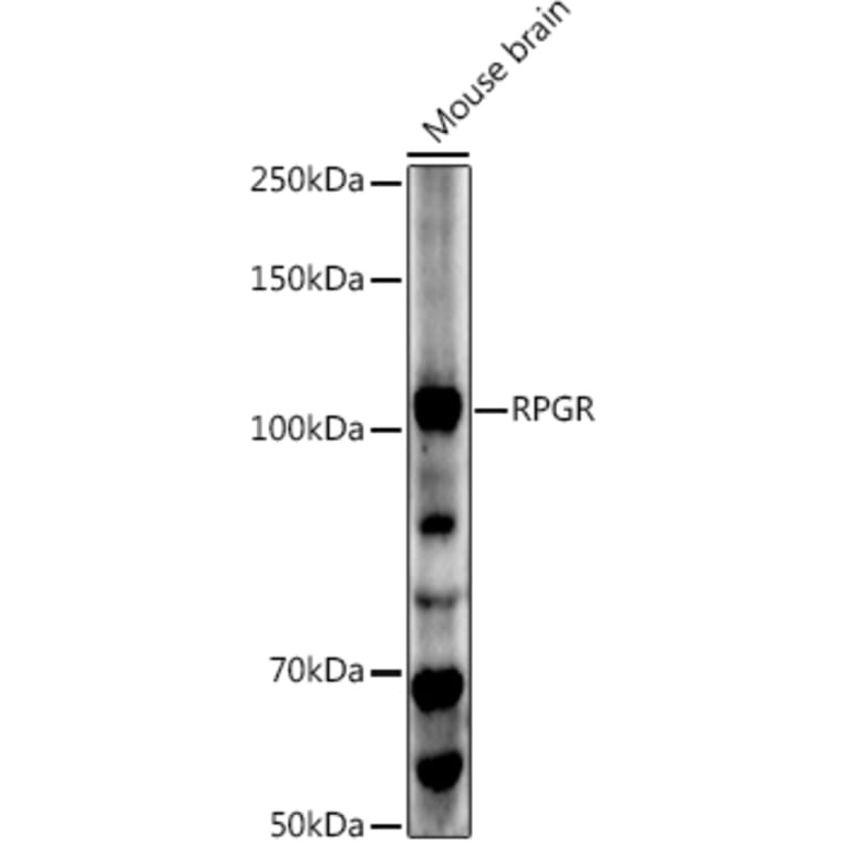 Western Blot - Anti-RPGR Antibody (A13696) - Antibodies.com