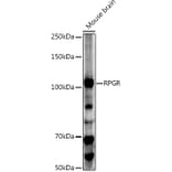 Western Blot - Anti-RPGR Antibody (A13696) - Antibodies.com