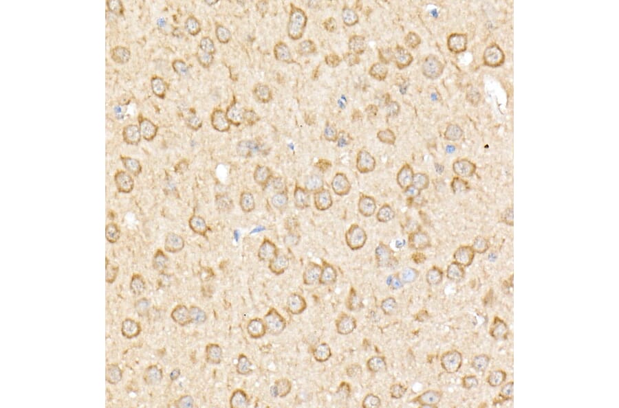 Immunohistochemistry - Anti-RPGR Antibody (A13696) - Antibodies.com