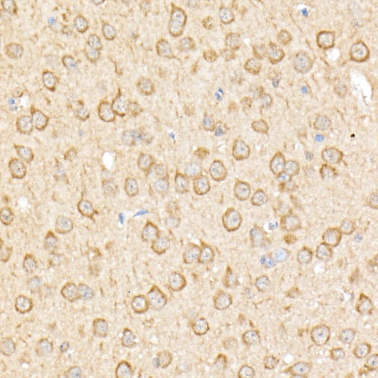 Immunohistochemistry - Anti-RPGR Antibody (A13696) - Antibodies.com