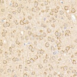 Immunohistochemistry - Anti-RPGR Antibody (A13696) - Antibodies.com